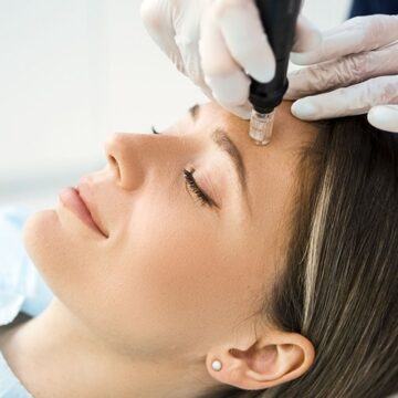 Microneedling Amsterdam