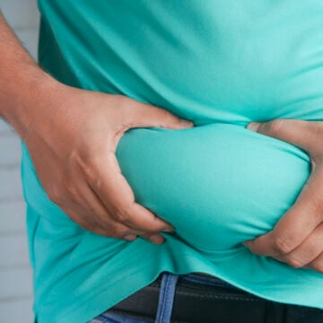 kliniek-271 Obesitas symptomen