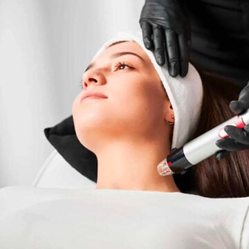 kliniek-385 RF Microneedling