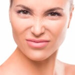 Bunny lines botox