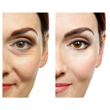 kliniek-414 Botox Amsterdam
